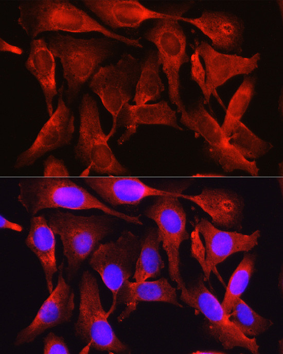 PCSK9 Antibody in Immunocytochemistry (ICC/IF)