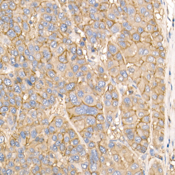 ATP1A1 Antibody in Immunohistochemistry (Paraffin) (IHC (P))