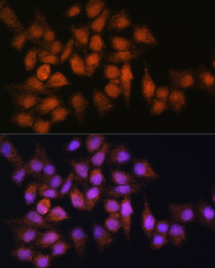 Bisphosphoglycerate mutase Antibody in Immunocytochemistry (ICC/IF)