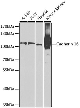 CDH16 Antibody in Western Blot (WB)