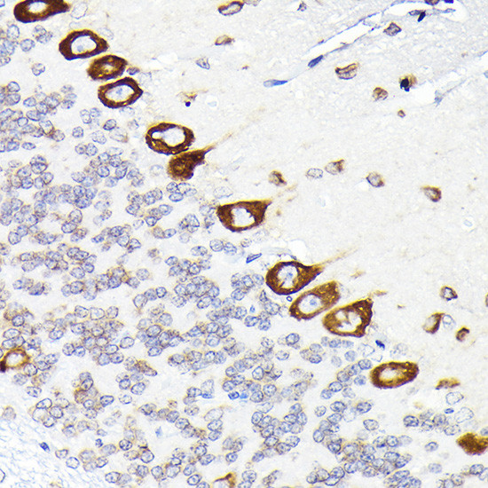 EEF1G Antibody in Immunohistochemistry (Paraffin) (IHC (P))