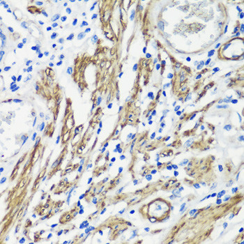 Filamin A Antibody in Immunohistochemistry (Paraffin) (IHC (P))