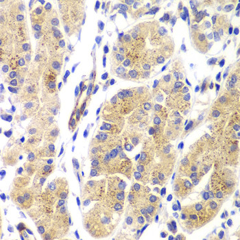 H-Ras Antibody in Immunohistochemistry (Paraffin) (IHC (P))