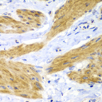 H-Ras Antibody in Immunohistochemistry (Paraffin) (IHC (P))