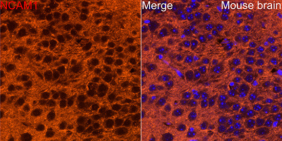 CD56 Antibody in Immunohistochemistry (Paraffin) (IHC (P))