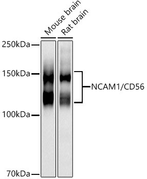 CD56 Antibody in Western Blot (WB)