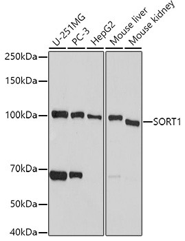 Sortilin Antibody in Western Blot (WB)