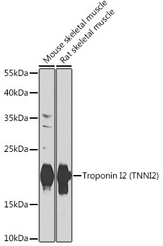 TNNI2 Antibody in Western Blot (WB)