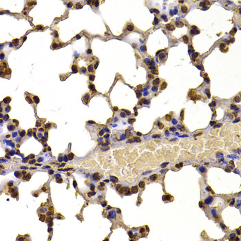 NSD2 Antibody in Immunohistochemistry (Paraffin) (IHC (P))