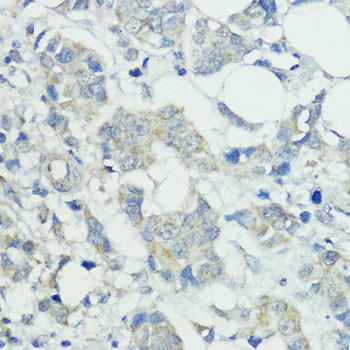 SOCS5 Antibody in Immunohistochemistry (Paraffin) (IHC (P))