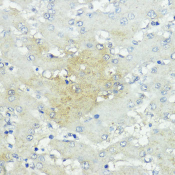 SOCS5 Antibody in Immunohistochemistry (Paraffin) (IHC (P))