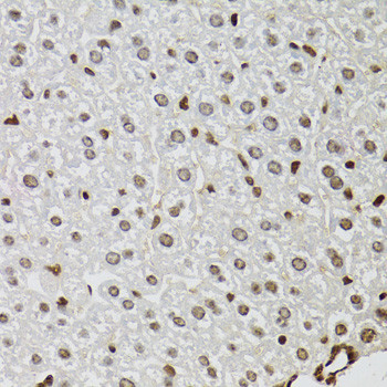 JMJD2A Antibody in Immunohistochemistry (Paraffin) (IHC (P))