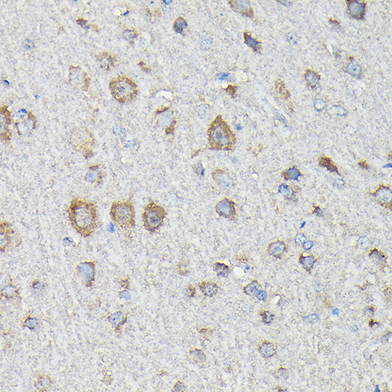 MTHFD1L Antibody in Immunohistochemistry (Paraffin) (IHC (P))