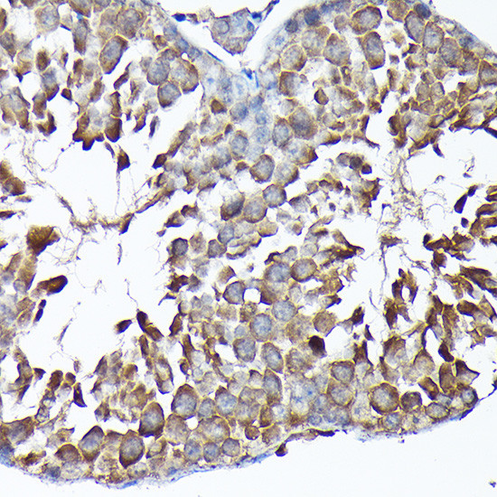 MTHFD1L Antibody in Immunohistochemistry (Paraffin) (IHC (P))