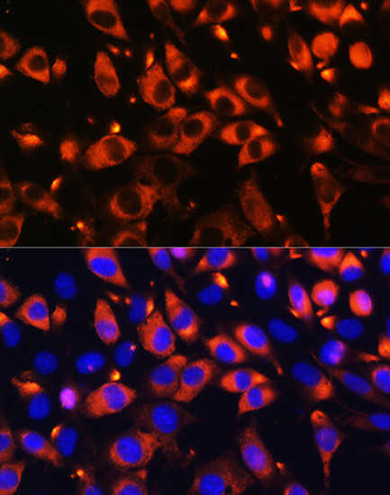 B9D1 Antibody in Immunocytochemistry (ICC/IF)