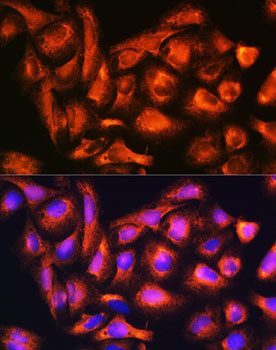 B9D1 Antibody in Immunocytochemistry (ICC/IF)