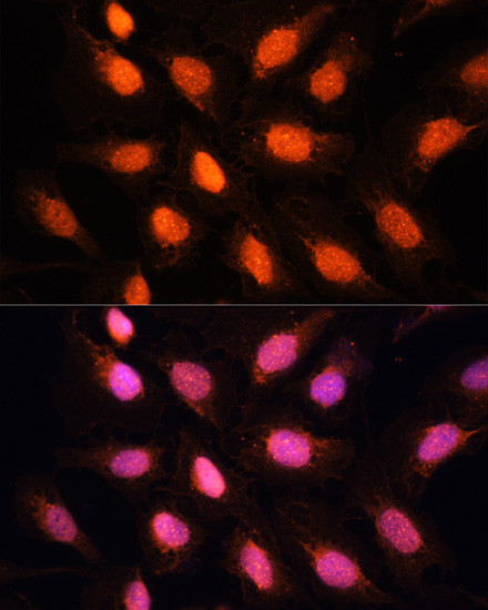 RAP1 Antibody in Immunocytochemistry (ICC/IF)