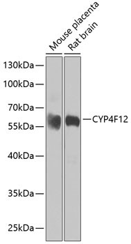 CYP4F12 Antibody in Western Blot (WB)