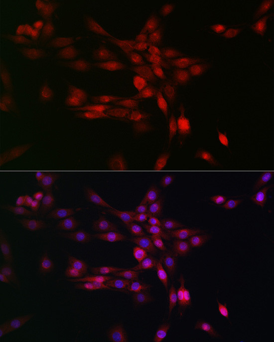 PHD3 Antibody in Immunocytochemistry (ICC/IF)