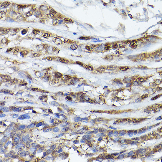 PHD3 Antibody in Immunohistochemistry (Paraffin) (IHC (P))