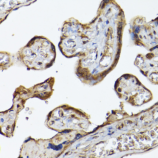 PHD3 Antibody in Immunohistochemistry (Paraffin) (IHC (P))