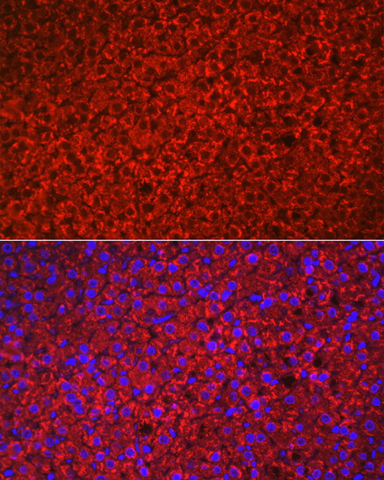 HSD3B1 Antibody in Immunohistochemistry (Paraffin) (IHC (P))