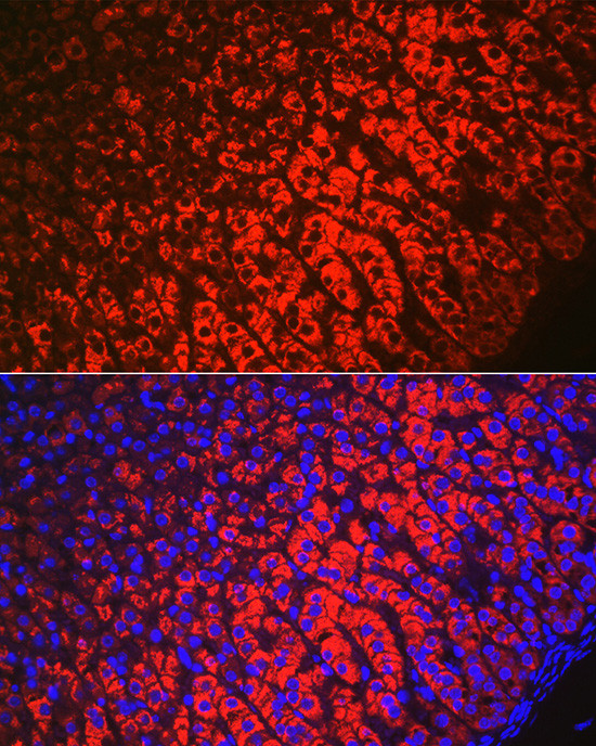 HSD3B1 Antibody in Immunohistochemistry (Paraffin) (IHC (P))