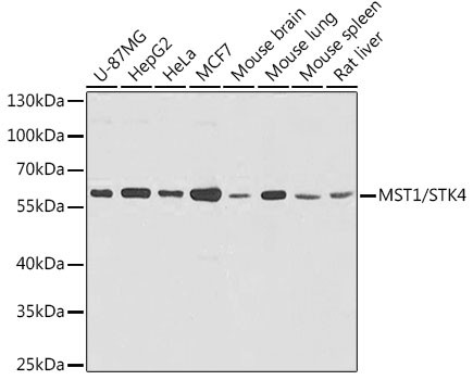 MST1 (STK4) Antibody in Western Blot (WB)