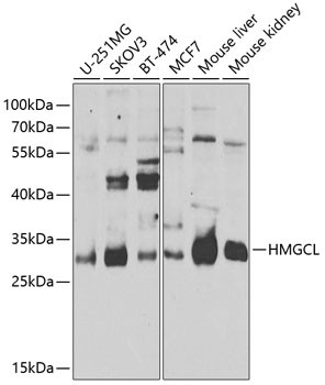 HMGCL Antibody in Western Blot (WB)