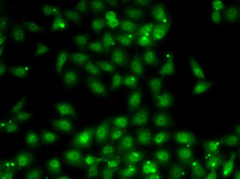 MBNL1 Antibody in Immunocytochemistry (ICC/IF)