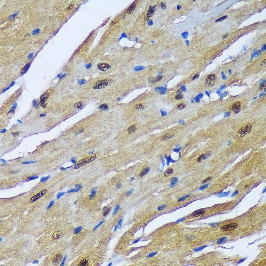 MBNL1 Antibody in Immunohistochemistry (Paraffin) (IHC (P))