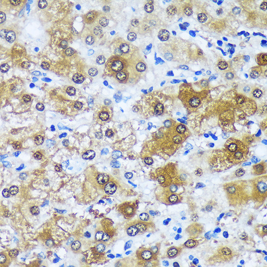 MBNL1 Antibody in Immunohistochemistry (Paraffin) (IHC (P))