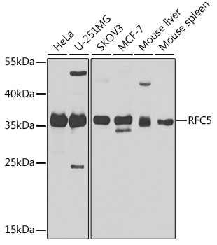 RFC5 Antibody in Western Blot (WB)