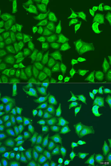 CAPZB Antibody in Immunocytochemistry (ICC/IF)