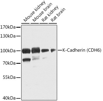 K-cadherin Antibody in Western Blot (WB)