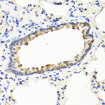 IFN omega Antibody in Immunohistochemistry (Paraffin) (IHC (P))