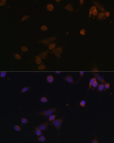 NDUFA2 Antibody in Immunocytochemistry (ICC/IF)