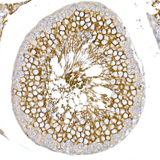 GLUT3 Antibody in Immunohistochemistry (Paraffin) (IHC (P))