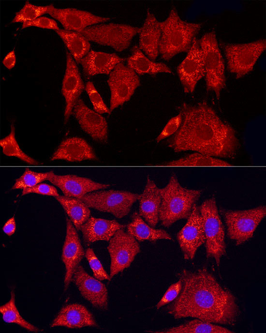 SLC25A11 Antibody in Immunocytochemistry (ICC/IF)