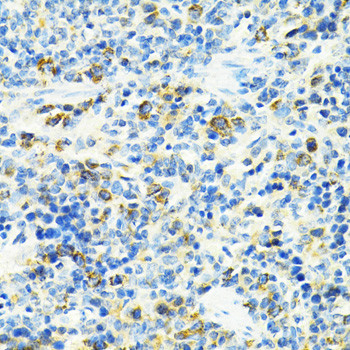 SLC25A11 Antibody in Immunohistochemistry (Paraffin) (IHC (P))