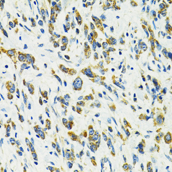 SLC25A11 Antibody in Immunohistochemistry (Paraffin) (IHC (P))