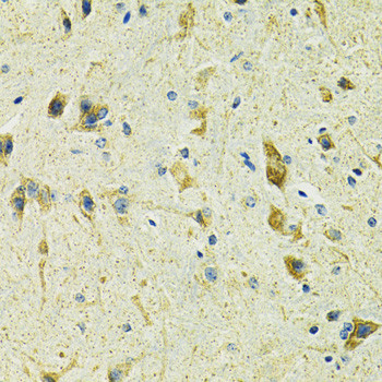 SLC25A11 Antibody in Immunohistochemistry (Paraffin) (IHC (P))