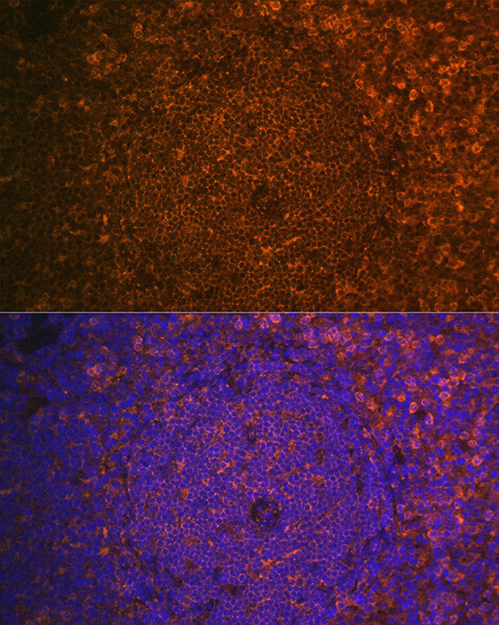 Cystatin F Antibody in Immunohistochemistry (Paraffin) (IHC (P))