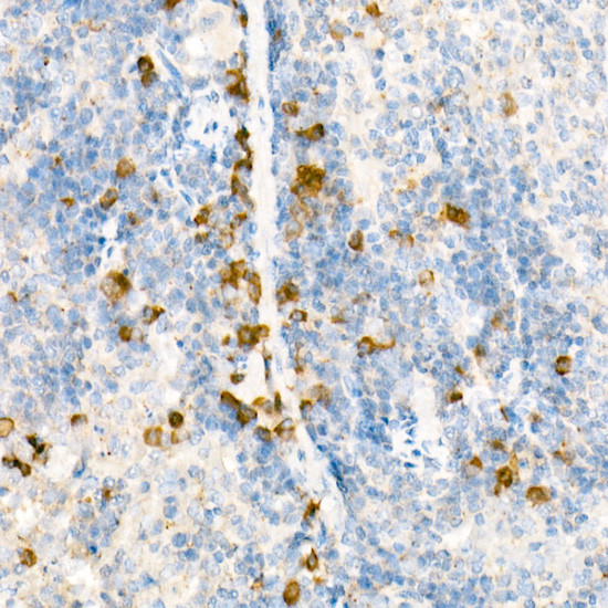 TCCR Antibody in Immunohistochemistry (Paraffin) (IHC (P))