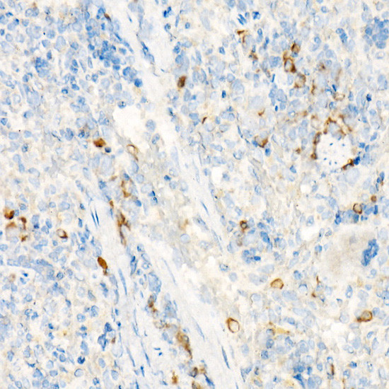 TCCR Antibody in Immunohistochemistry (Paraffin) (IHC (P))