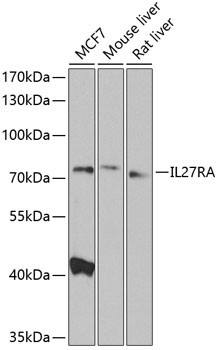 TCCR Antibody in Western Blot (WB)