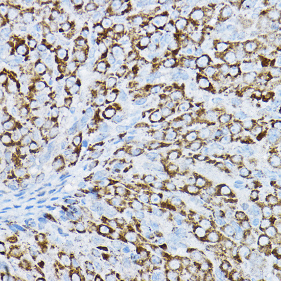 P2Y14 Antibody in Immunohistochemistry (Paraffin) (IHC (P))