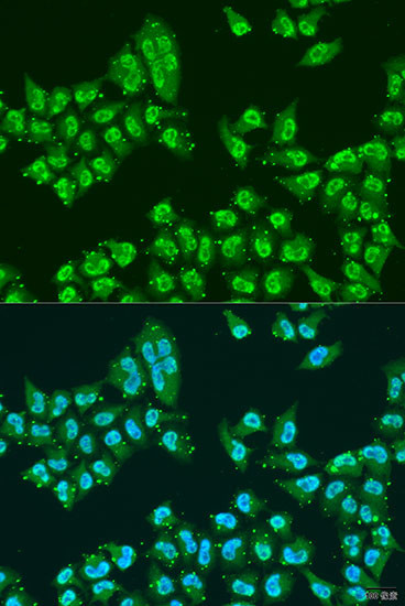 Nuclear Matrix Protein p84 Antibody in Immunocytochemistry (ICC/IF)