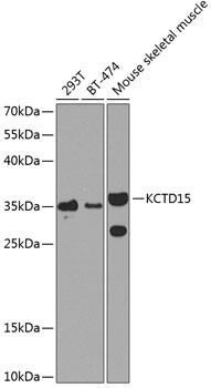 KCTD15 Antibody in Western Blot (WB)