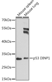 p53DINP1 Antibody in Western Blot (WB)